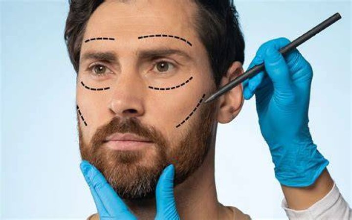 Moving Beyond Plastic Surgery in Life With Treacher Collins Syndrome