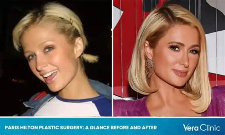 Paris Hilton Denies Plastic Surgery, Is 100 Percent Real Hollywood