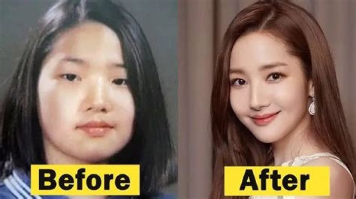 Park Min Young plastic surgery Nose Job, Double eyelid surgery, Facelift