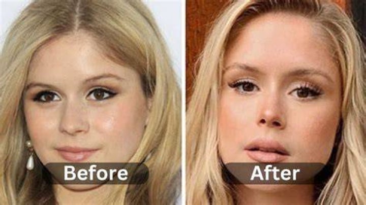 Toni Fowler Plastic Surgery Before and After Photos See Difference